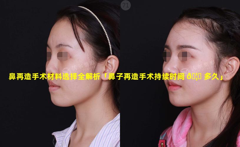 鼻再造手术材料选择全解析「鼻子再造手术持续时间 🦄 多久」